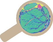 CT viewer